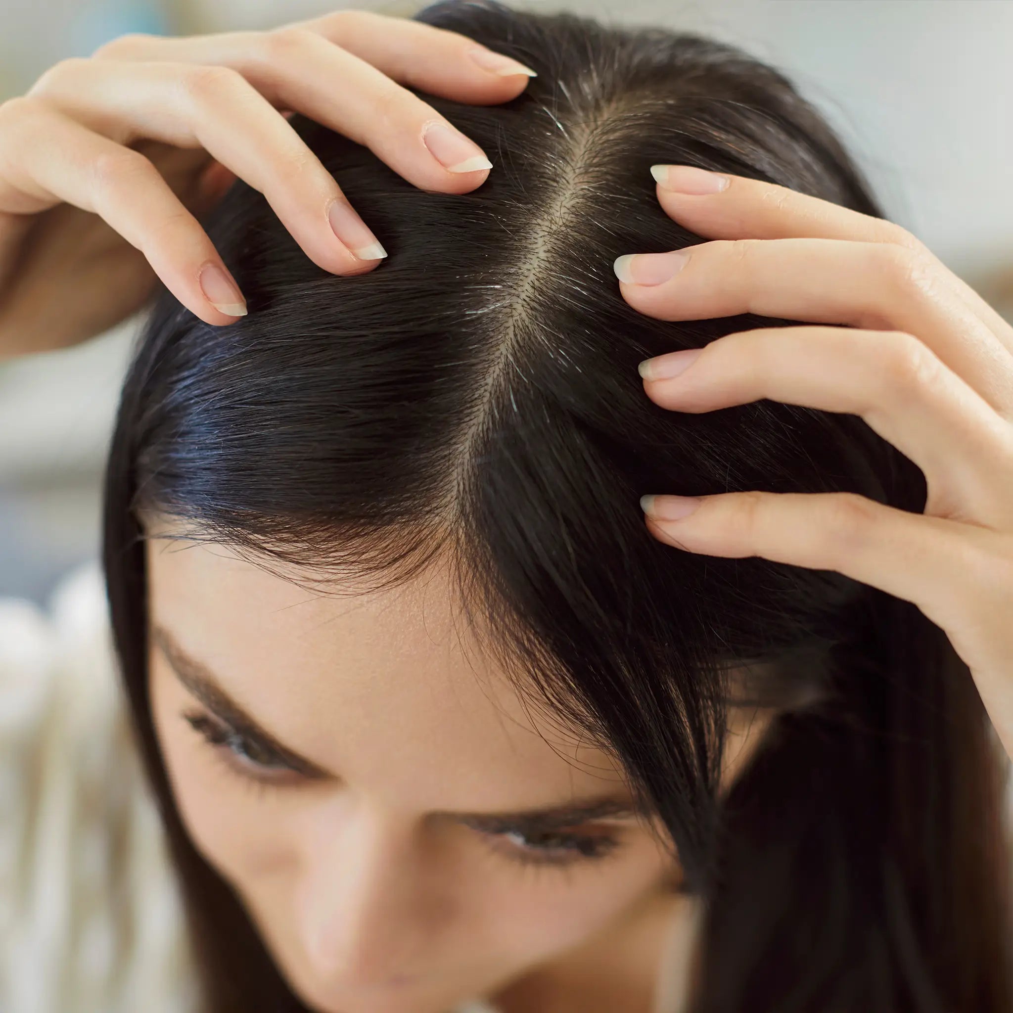 Smart DNA - Hair Loss Profile